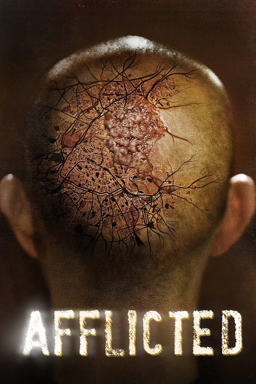 Xem phim Sức Mạnh Dị Thường - Afflicted (2014)